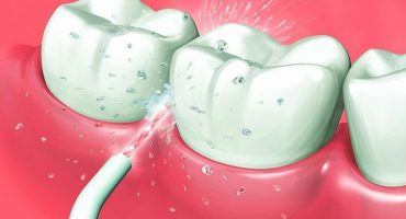 Oral irrigator - vilket är bättre att välja och varför du behöver det