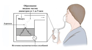 Regler för användning av en inhalator: hur det fungerar och varför?